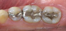 before dental treatment image