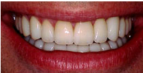 after dental treatment image