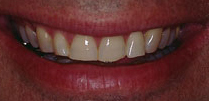 before dental treatment image