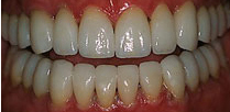 after dental treatment image