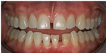 before dental treatment image