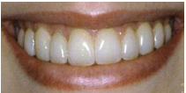 after dental treatment image