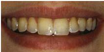 before dental treatment image