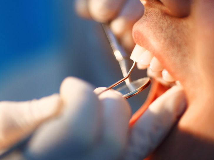 dental check-up