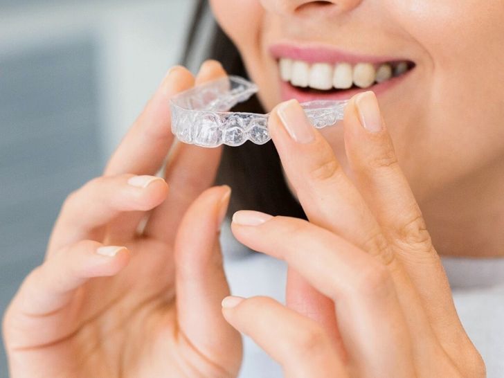 Price of Invisalign