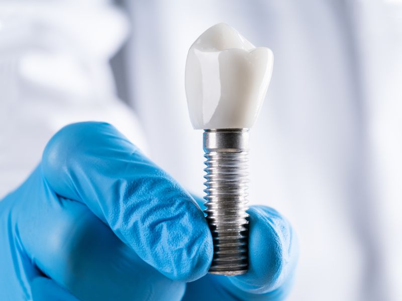 Comparing dentures vs implants? Learn the differences in cost, comfort, longevity, and appearance to decide which tooth replacement option is best for you in Vancouver.